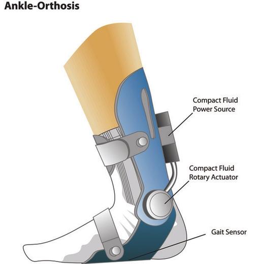 The development of a light, compact, efficient, ultra-low-powered, untethered Ankle Foot Orthosis (AFO) system has the potential to yield significant advances in orthotic control mechanisms and treatment strategies.