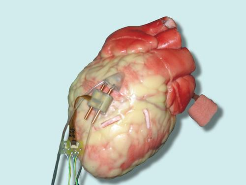 This previous HeartLander prototype uses onboard motors, measuring 8.5mm high, 15mm wide, and 46mm long.