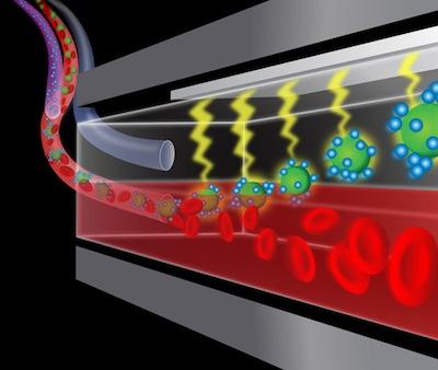 An artist's concept of how a device designed by the Defense Advanced Research Project Agency's Dialysis-Like Therapeutics program would remove 'dirty' blood and replace it with 'clean' blood in the treatment of sepsis.   (Source: DARPA) 