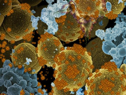 A magnified view of IVN therapeutics on bacteria. The Defense Advanced Research Agency hopes to use nanotechnology to treat diseases and other soldier afflictions, such as traumatic brain injury.   (Source: DARPA)