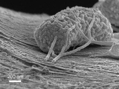 Stanford researchers have created a microbial battery that uses exoelectrogenic microbes (shown here) that produce electricity as they digest plant and animal waste.