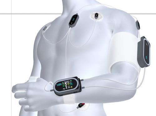 Sotera Wireless' Visi Mobile performs all the monitoring functions of a hospital for patients, no matter where they are located.(Source: Sotera)