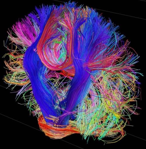 Using biological computational models like the brain reveals that it distributes memory (synapses) between every computing node (neuron) and is interconnect-limited. However, it compensates by being much more energy efficient -- by using slower switching speeds, low supply voltages, liquid cooling, and a very different power network.
(Source: Human Connectome Project)