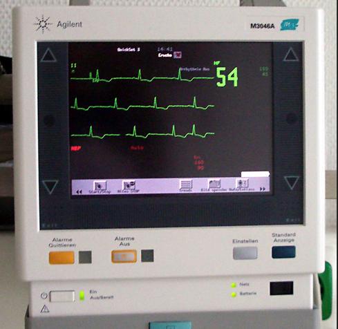 Heart monitor