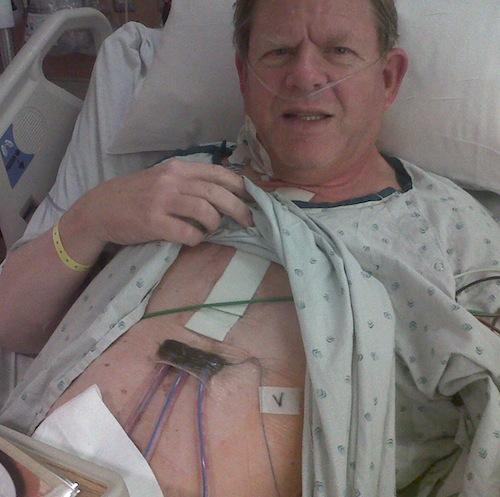 Recuperating from bypass surgery.